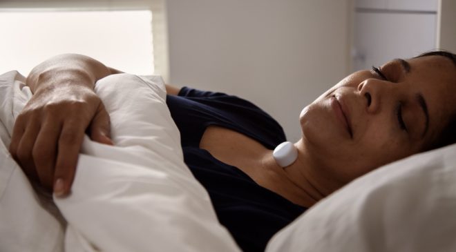 AcuPebble is changing the face of sleep apnoea diagnosis