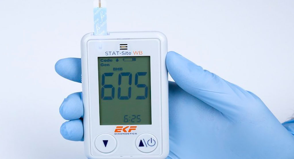 EKF Diagnostics to showcase latest POCT solutions at MEDICA