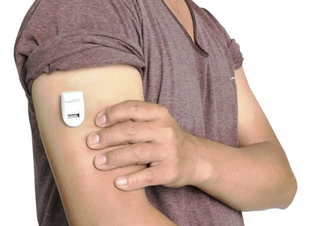 The working behinds the “world’s first” non-invasive CGM multi-sensor device